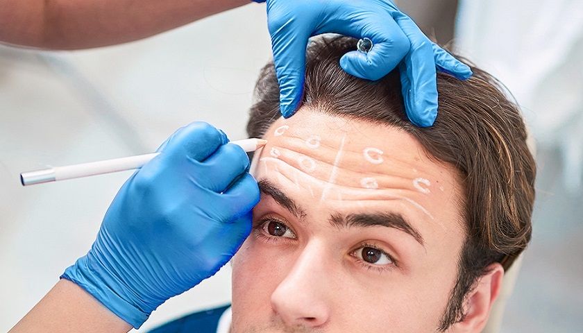 The growing popularity of Botulinum Toxin for men (“Brotox”)