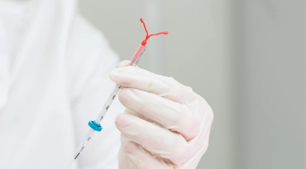 Intrauterine Device (IUD) Insertion