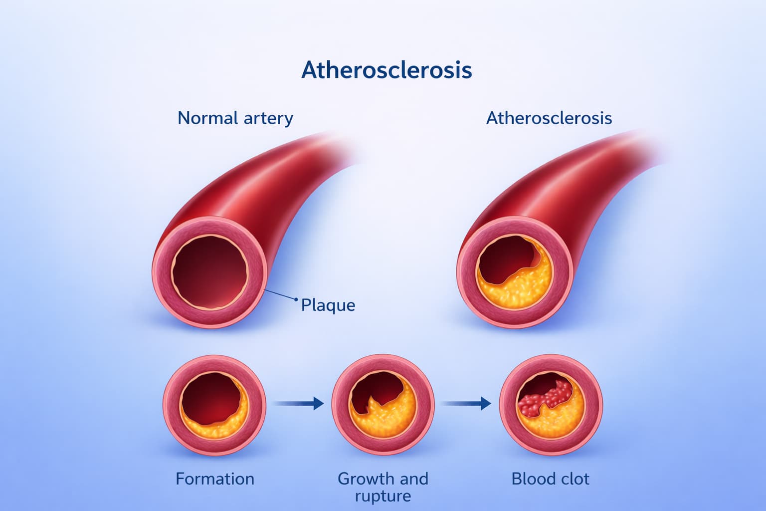 Mounjaro and the Heart