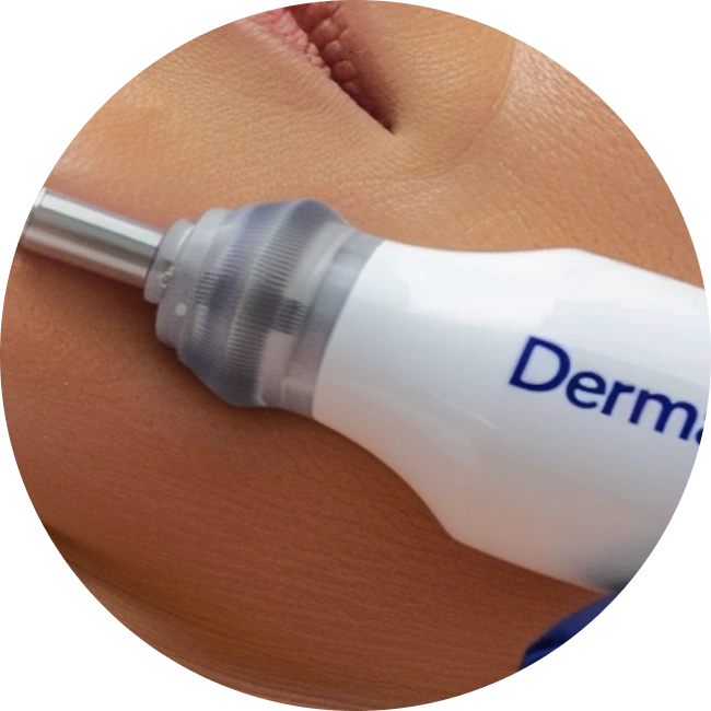 Dermapen + PRP