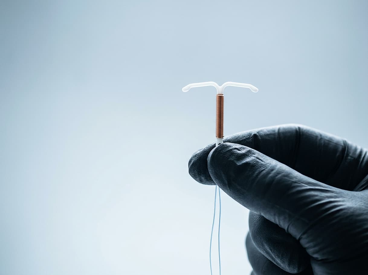 Intrauterine device (IUD) insertion