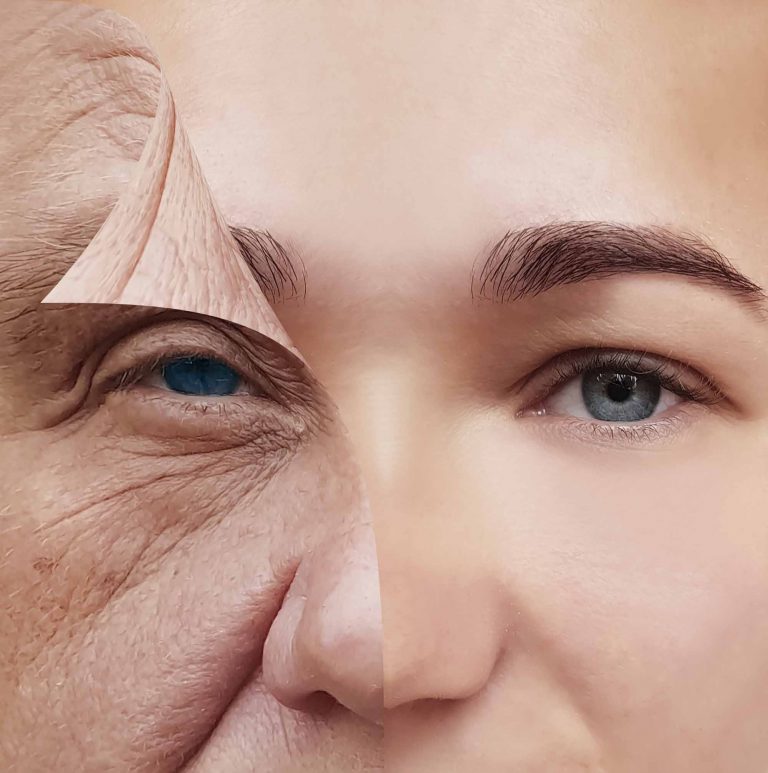 How to rejuvenate facial skin