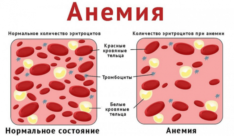 What tests should be done for anemia