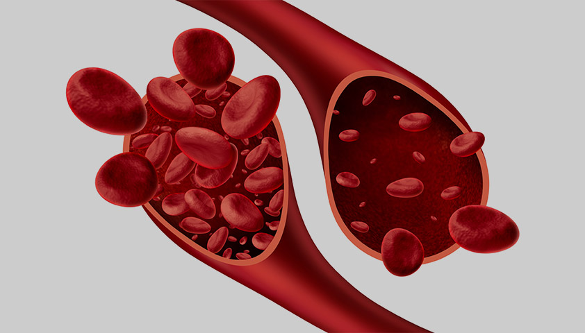 How to treat anemia?