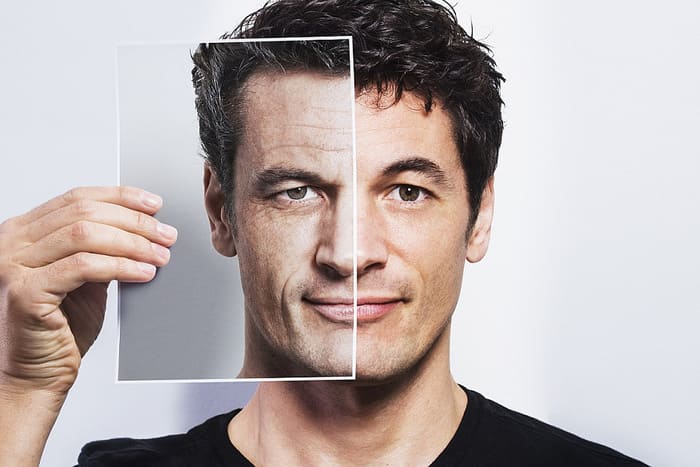 The growing popularity of Botulinum Toxin for men (“Brotox”)