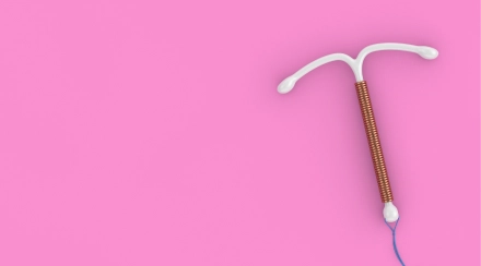 Removal of Intrauterine Device (IUD)
