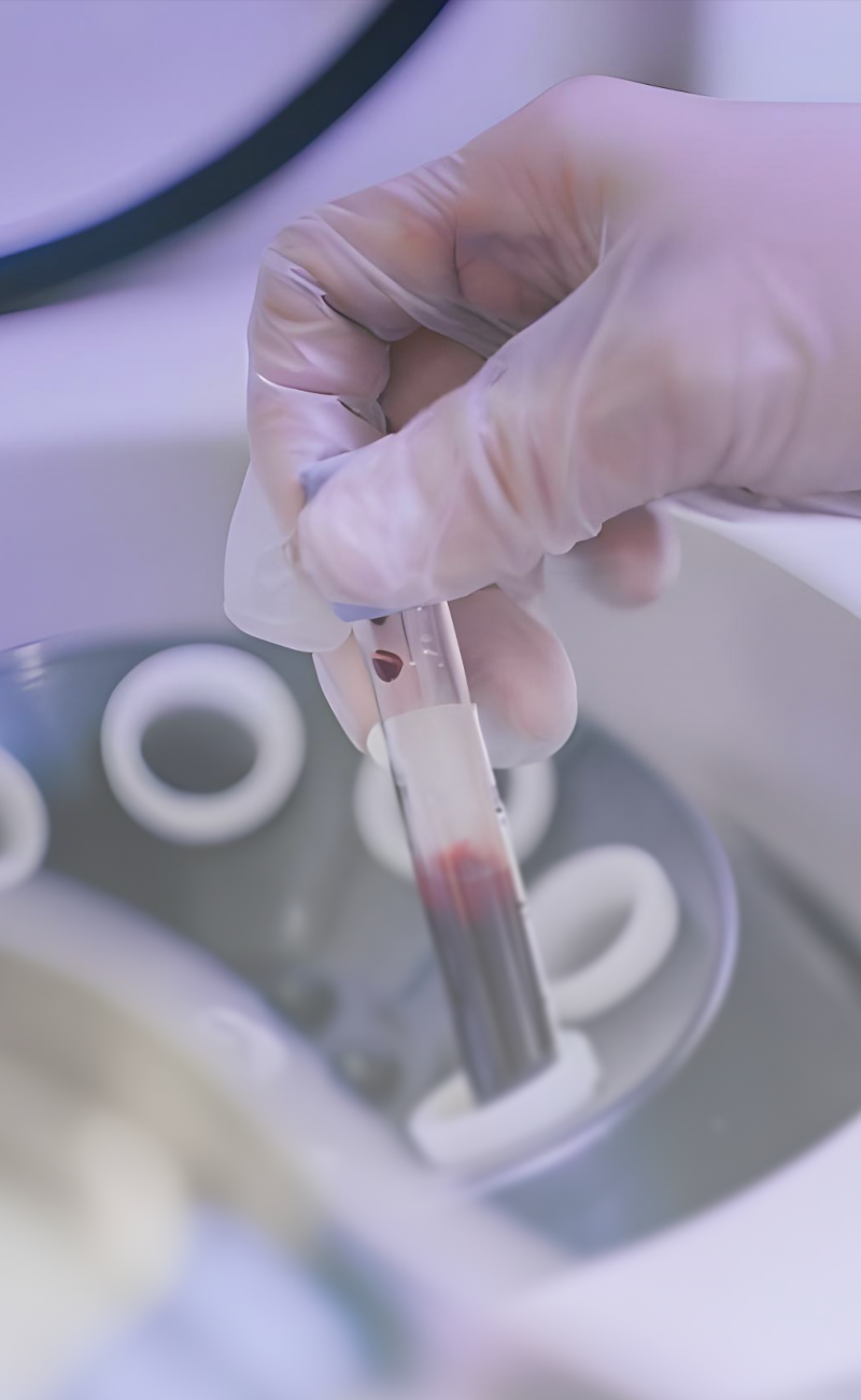 PRP Therapy (Platelet-Rich Plasma Therapy)