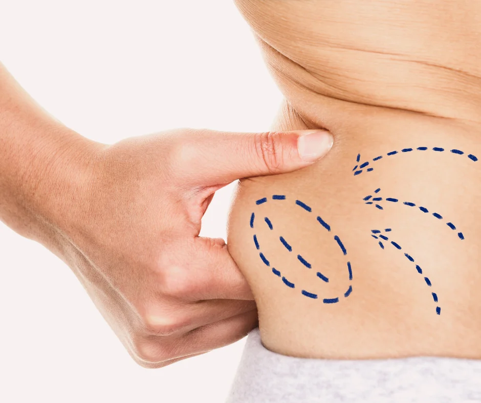 AOD-9604: a peptide for weight loss and improved body composition