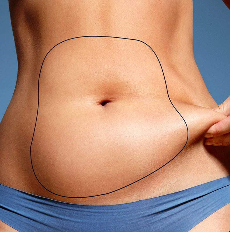 How to get rid of a belly apron
