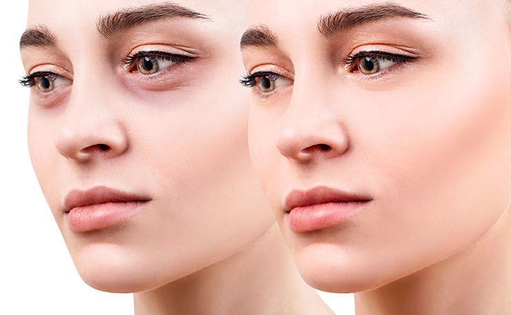 How to remove facial swelling?