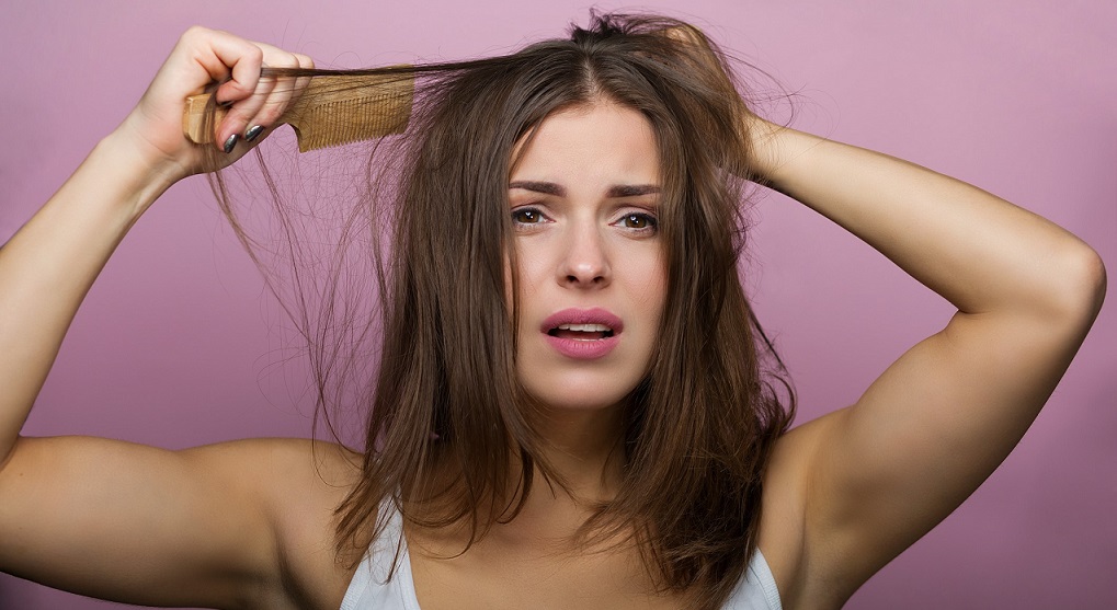 Androgenetic alopecia
