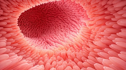 Abdominal Ultrasound