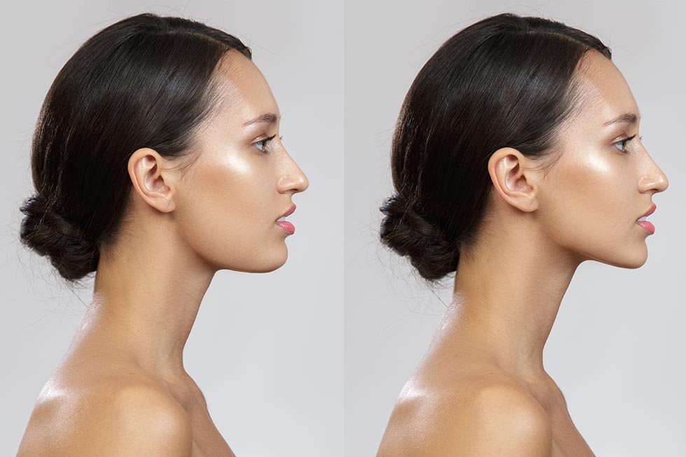 How to get rid of a double chin
