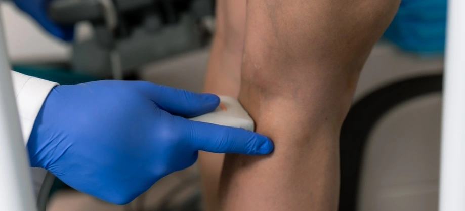 Why does a vein hurt after an IV drip?
