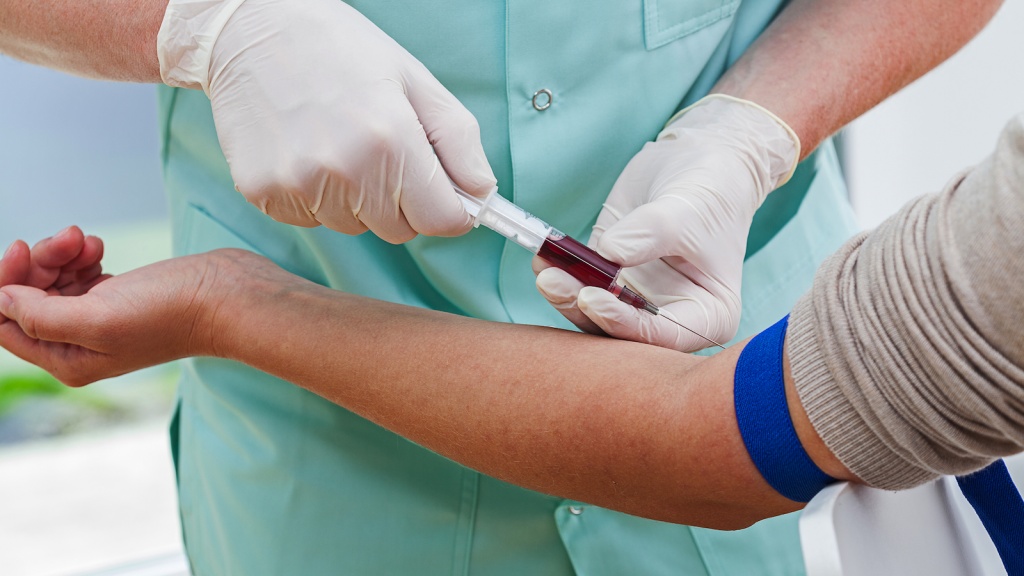 Female hormone tests: when to take them?