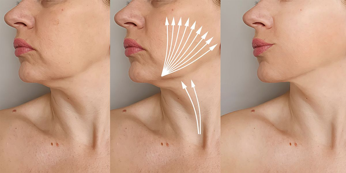 How to get rid of a double chin