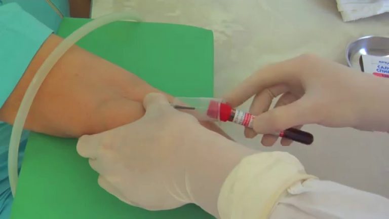 What should not be done after having blood drawn from a vein for tests