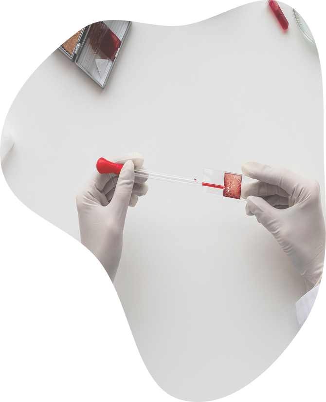 Check-up «Stress Diagnosis»