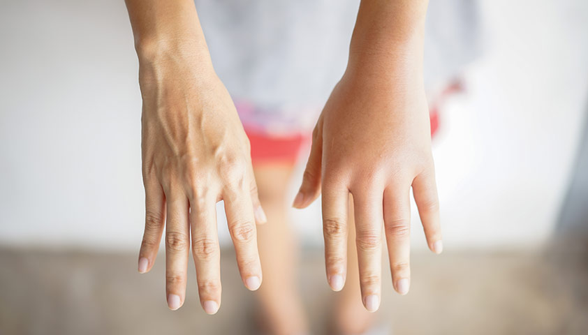 How to get rid of body swelling?