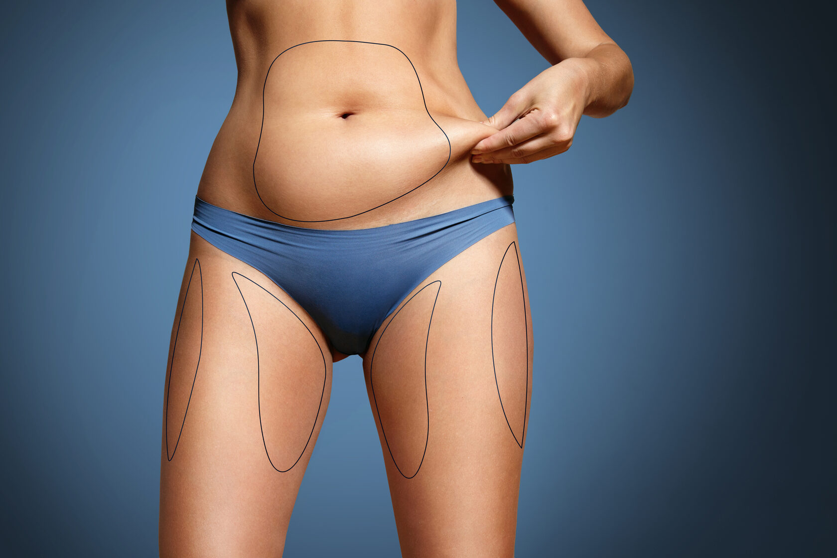 Body fat-dissolving injections as a non-surgical alternative to liposuction in Dubai