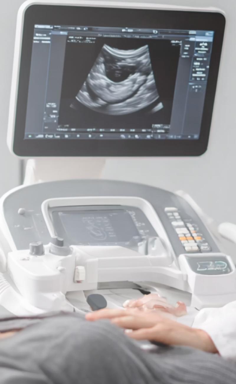 4D Fetal Scanning