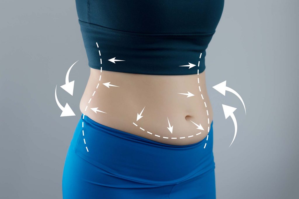 How to get rid of body swelling?