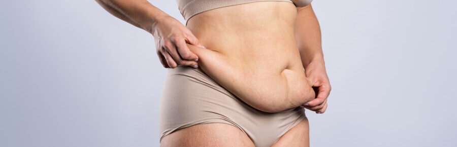 How to tighten loose skin after weight loss without surgery