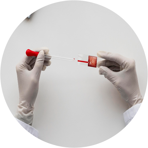 Check-up «Stress Diagnosis»