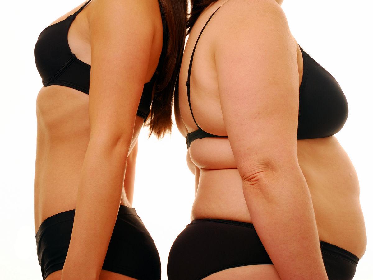 Abdominal obesity