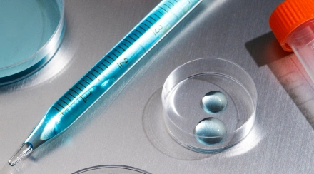 Check-up «Kidney Function Test»