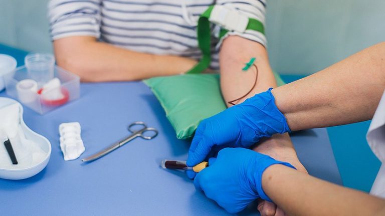 Female hormone tests: when to take them?
