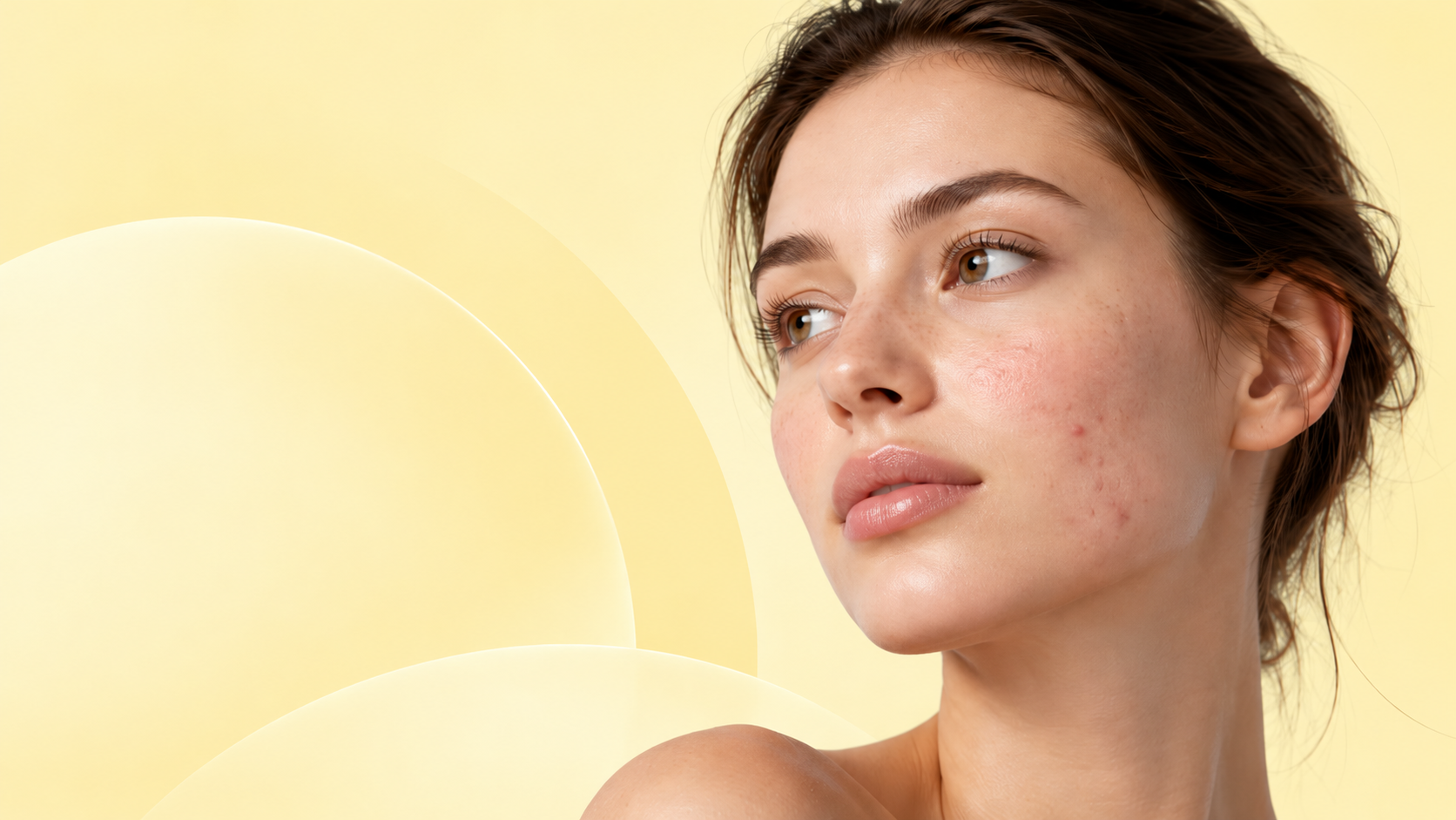 Retinoids for Acne: What You Need to Know Before Starting Treatment