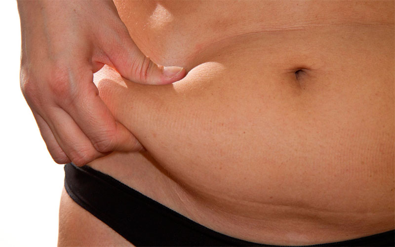 Why does only the belly get fat?