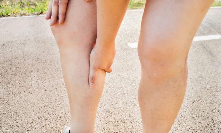 Why do calves cramp