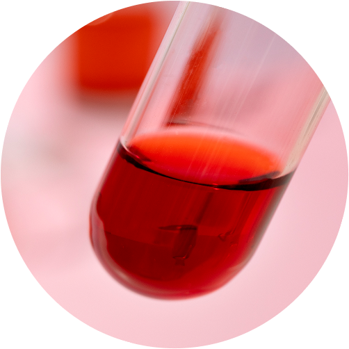 Check-up «Anemia Test»
