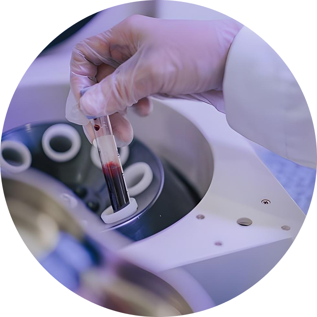 PRP Therapy (Platelet-Rich Plasma Therapy)