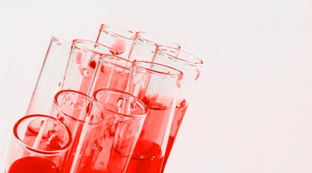 Check-up «Lipid Profile»