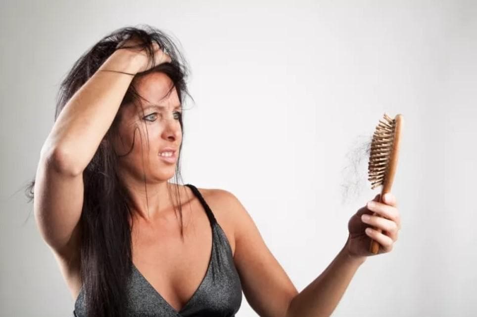 Androgenetic alopecia