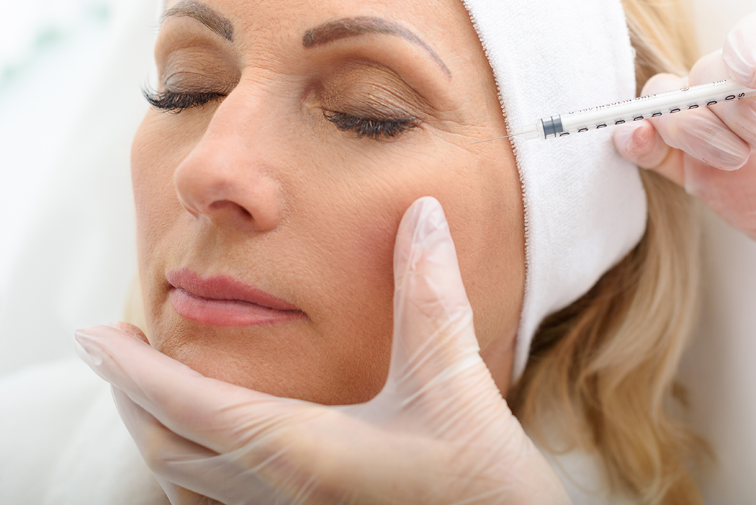 Baby Botox vs Classic Botox — choosing the most natural-looking result
