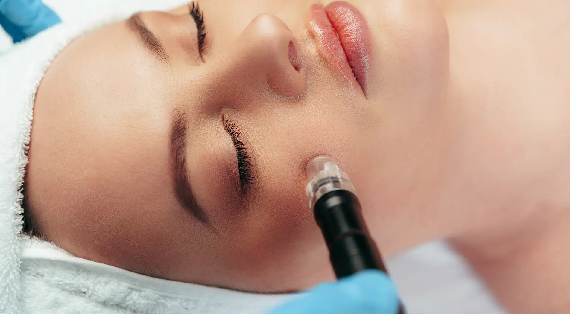  GLOW SHOT — IV Therapy + Hydrafacial