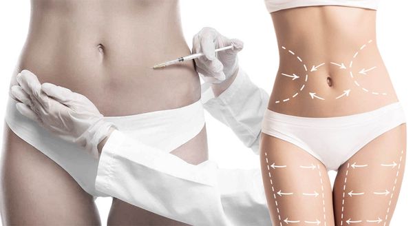 Body fat-dissolving injections as a non-surgical alternative to liposuction in Dubai