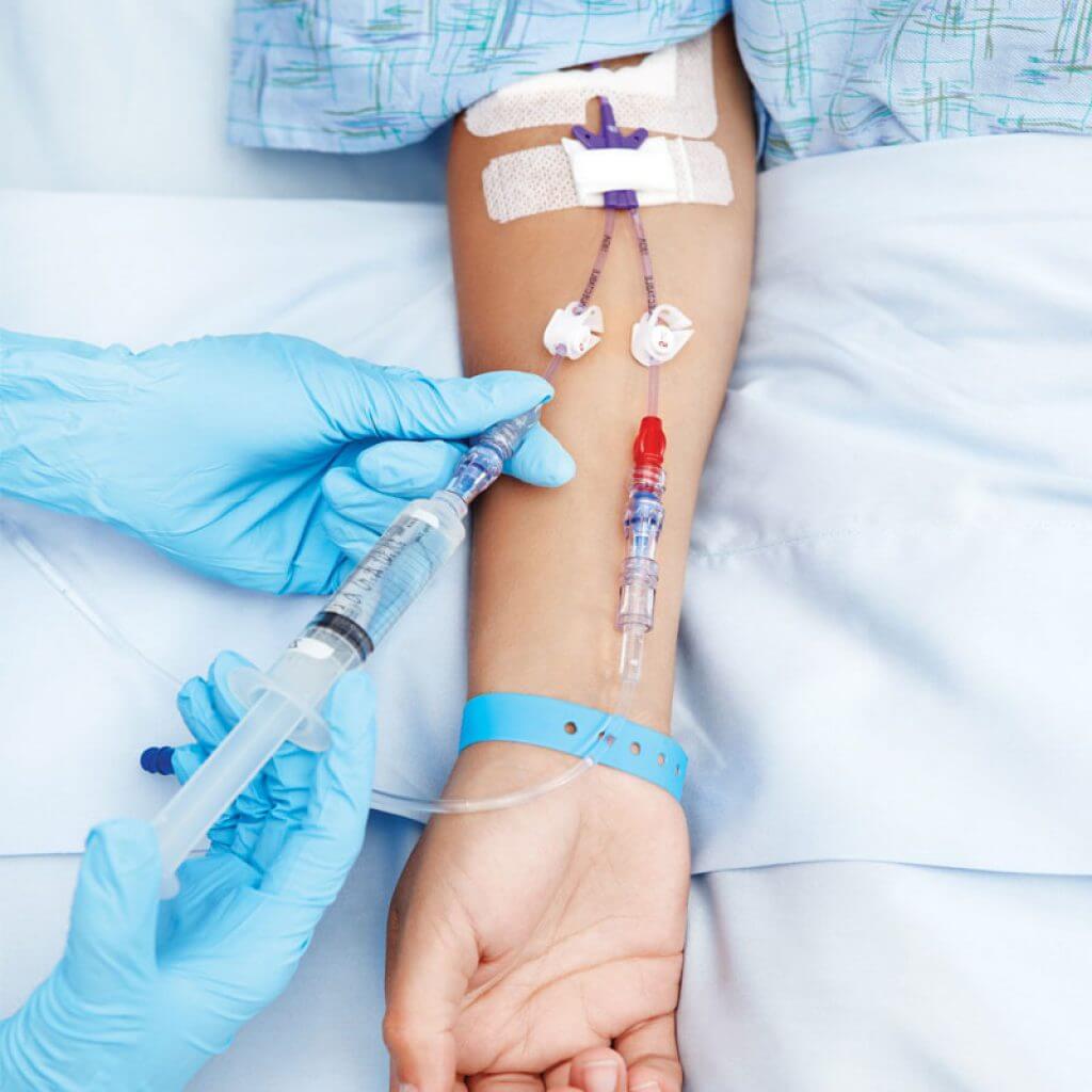 How does an IV drip work