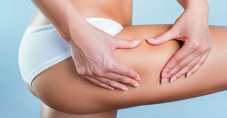 How to get rid of cellulite