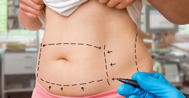 How long does it take for lipolytic injections to work?